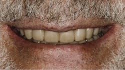 1810debur P01 1810debur P01