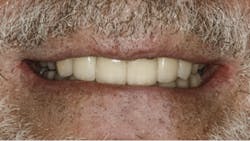 1810debur P02 1810debur P02