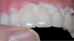 1810debur P04 1810debur P04