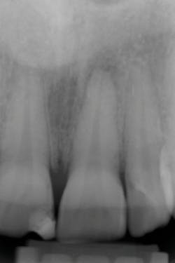 1810dedok P03 1810dedok P03