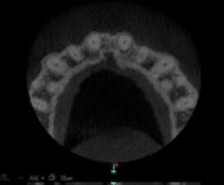 1810dedok P05 1810dedok P05