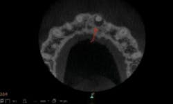 1810dedok P06 1810dedok P06