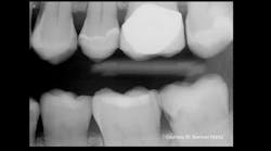 1811dechr P01 1811dechr P01