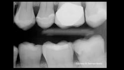 1811dechr P01 1811dechr P01