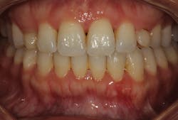 1811defro P01 1811defro P01