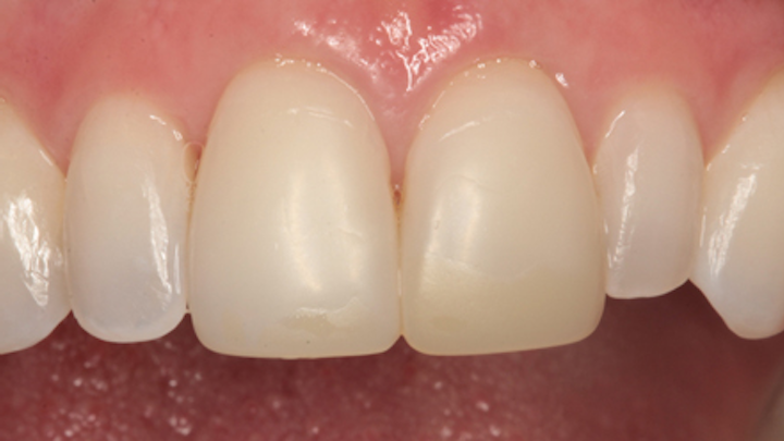 1811denas P01
