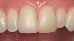 1811denas P01