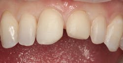 1811denas P02 1811denas P02