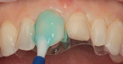 1811denas P03 1811denas P03