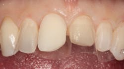 1811denas P04 1811denas P04