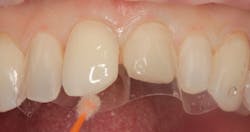 1811denas P05 1811denas P05