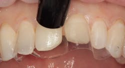 1811denas P06 1811denas P06