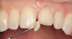 1811denas P07 1811denas P07