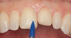 1811denas P08 1811denas P08