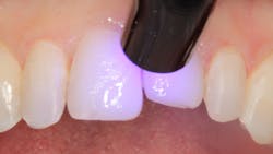 1811denas P09 1811denas P09