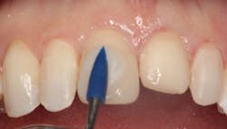 1811denas P10 1811denas P10