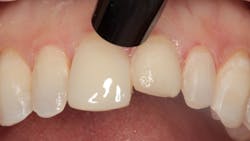 1811denas P11 1811denas P11