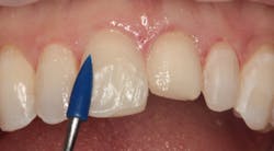 1811denas P12 1811denas P12