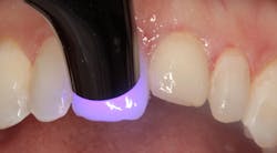 1811denas P13 1811denas P13