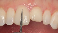 1811denas P14 1811denas P14