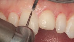 1811denas P15 1811denas P15