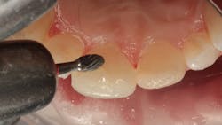 1811denas P16 1811denas P16