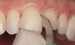 1811denas P17 1811denas P17