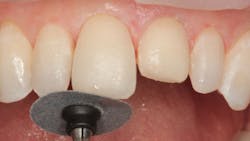 1811denas P18 1811denas P18