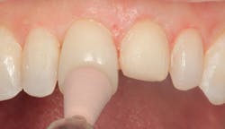 1811denas P20 1811denas P20