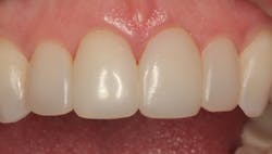 1811denas P21 1811denas P21