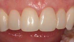 1811denas P22 1811denas P22