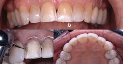 1812dechr P05 1812dechr P05