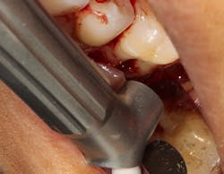 1812defro P02 1812defro P02