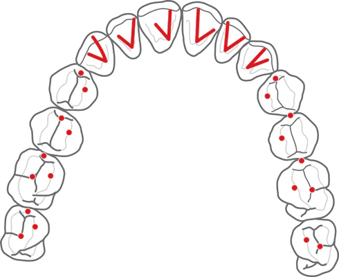 Teeth Contacts