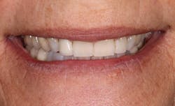 1901desis P03 1901desis P03