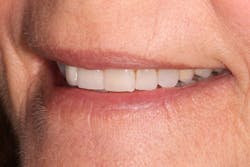 1901desis P04 1901desis P04