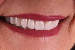 1901desis P10 1901desis P10