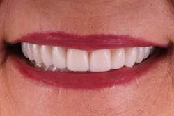 1901desis P11 1901desis P11