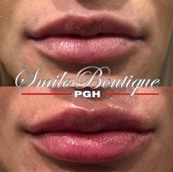 1901delou P01 1901delou P01