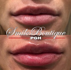 1901delou P01 1901delou P01