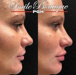 1901delou P02 1901delou P02