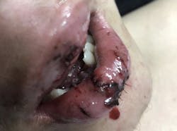 1903defro P01 1903defro P01