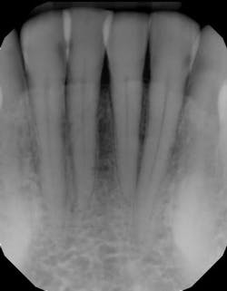 1903defro P03 1903defro P03