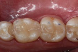 1903delaw P10 1903delaw P10