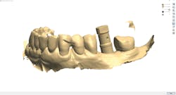 1903demoo P04 1903demoo P04