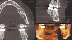 Content Dam De En Articles Print Volume 106 Issue 8 Science Tech A Radiologist S View Of In Office Cbct Interview With Jeffery B Price Dds Ms Leftcolumn Article Thumbnailimage File Content Dam De En Articles Print Volume 106 Issue 8 Science Tech A Radiologist S View Of In Office Cbct Interview With Jeffery B Price Dds Ms Leftcolumn Article Thumbnailimage File