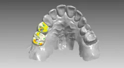 Content Dam De En Articles Print Volume 107 Issue 12 Science Tech Does Digital Dentist Mean Anything Today Leftcolumn Article Thumbnailimage File