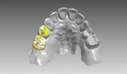 Content Dam De En Articles Print Volume 107 Issue 12 Science Tech Does Digital Dentist Mean Anything Today Leftcolumn Article Thumbnailimage File Content Dam De En Articles Print Volume 107 Issue 12 Science Tech Does Digital Dentist Mean Anything Today Leftcolumn Article Thumbnailimage File