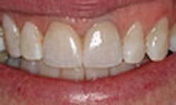 LaserFousWorld Test LaserFousWorld Test