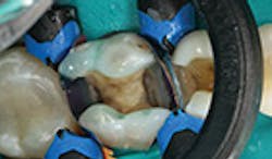 LaserFousWorld LaserFousWorld